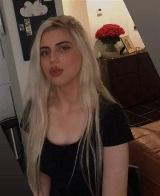 random escort 15