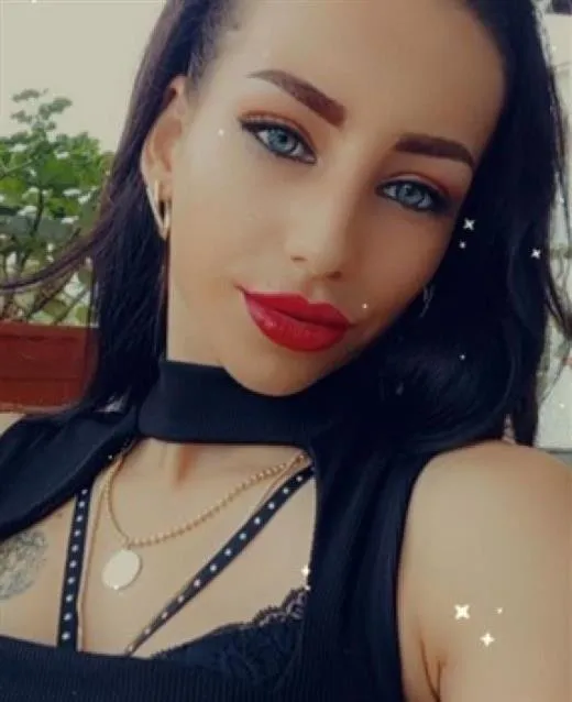 random escort 57