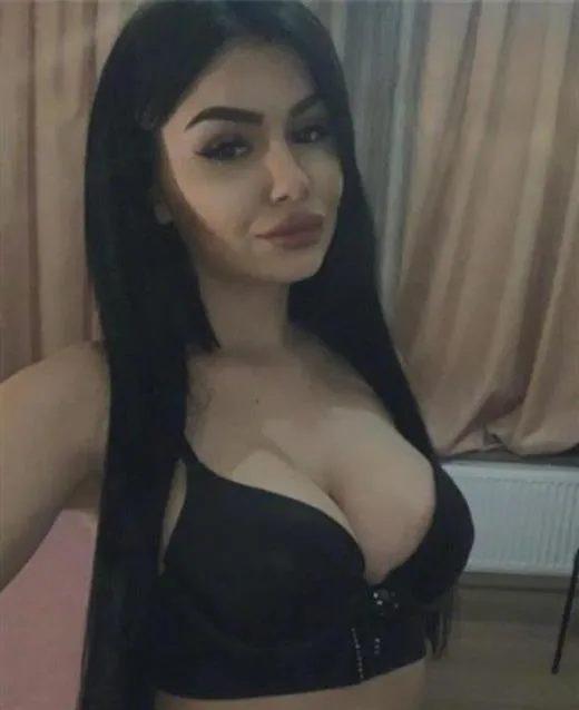 random escort 69